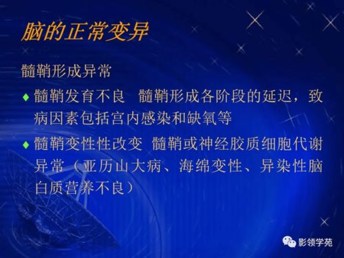 颅脑的影像解剖与常见变异 医学研究新视角